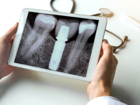 Understanding the Role of Digital X-Ray Technology in Accurate Orthopaedic Diagnoses